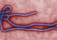 Um virião do vírus Ebola em imagem colorida obtida pela Reuters. 1/08/2014.